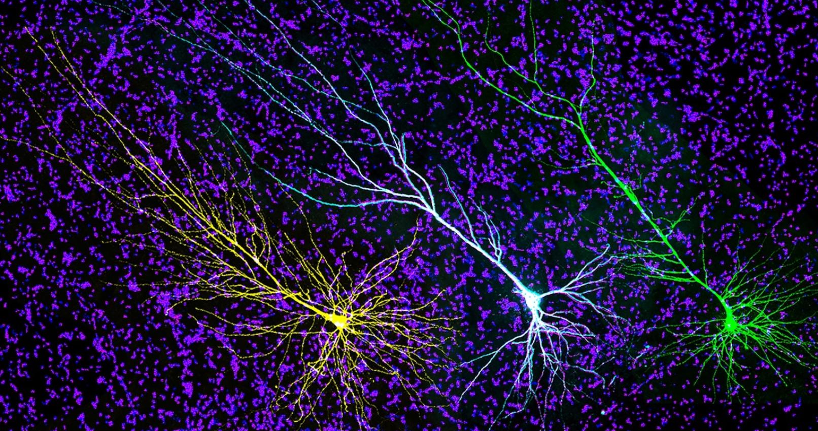 3 pyramidal neurons in human cortex