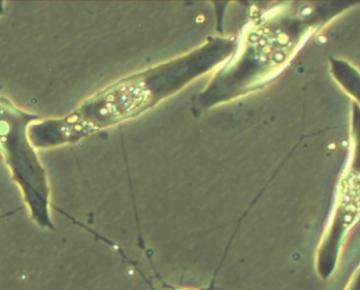 Neurotransmitter
